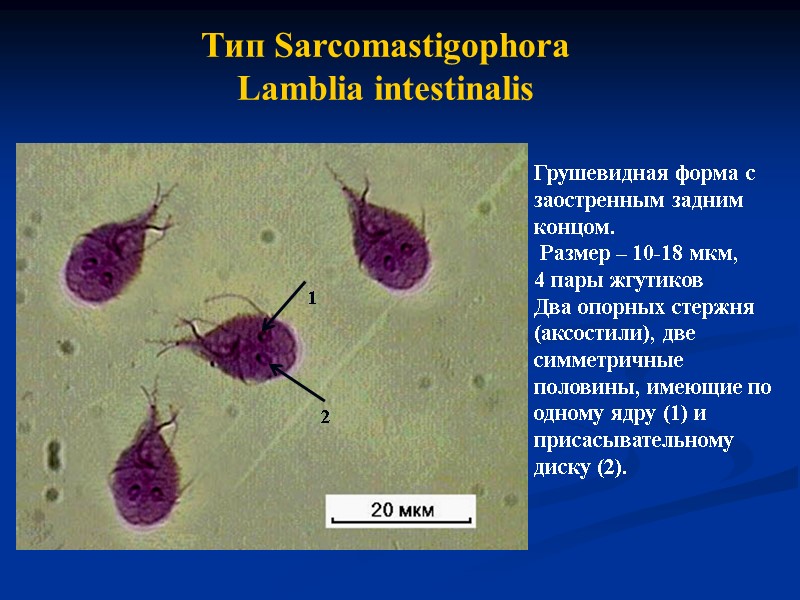 Тип Sarcomastigophora Lamblia intestinalis Грушевидная форма с заостренным задним концом.  Размер – 10-18